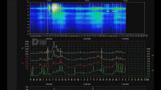 mqdefault 15274 Ελληνική Έκλαμψη Του Ήλιου Μας Γεωμαγνητική Καταιγίδα https://eliniki.gr/video/%cf%80%ce%bf%cf%85-%cf%83%cf%85%ce%bd%ce%b1%ce%bd%cf%84%ce%b9%ce%bf%cf%8d%ce%bd%cf%84%ce%b1%ce%b9-%ce%bc%ce%b1%cf%83%ce%bf%ce%bd%ce%bf%ce%b9-%ce%ba%ce%b1%ce%b9-%ce%b1%cf%80%ce%bf%ce%ba%cf%81%cf%85/