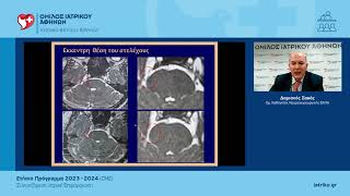 663d42bdd056f Ελληνική Grand Rounds Νευροχειρουργικής | Δ. Σακάς https://eliniki.gr/video/15%ce%bf-%cf%80%ce%b1%ce%b9%ce%b4%ce%b9%ce%b1%cf%84%cf%81%ce%b9%ce%ba%cf%8c-%cf%83%cf%85%ce%bd%ce%ad%ce%b4%cf%81%ce%b9%ce%bf-%ce%b1-%cf%86%cf%81%ce%b5%cf%84%ce%b6%ce%ac%ce%b3%ce%b9%ce%b1/