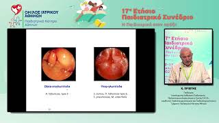 17ο Παιδιατρικό Συνέδριο – Κ. Πρίφτης