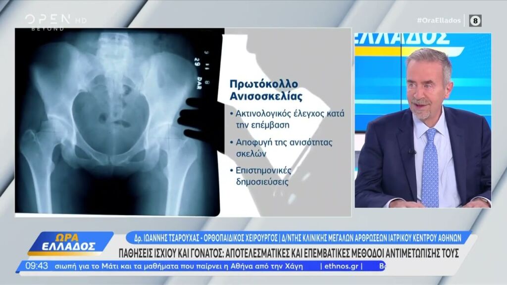 Παθήσεις ισχίου και γόνατος: Οριστική λύση: Ολική αρθροπλαστική ASI | Ιωάννης Τσαρούχας