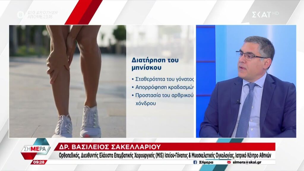 Σύγχρονες Τεχνικές Συρραφής Μηνίσκου | Βασίλειος Σακελλαρίου