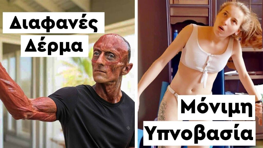 8 Άνθρωποι με τις πιο ΣΠΑΝΙΕΣ παθήσεις στον κόσμο